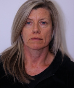 anti-wrinkle injections before