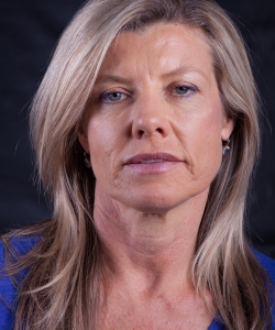 anti-wrinkle injections after